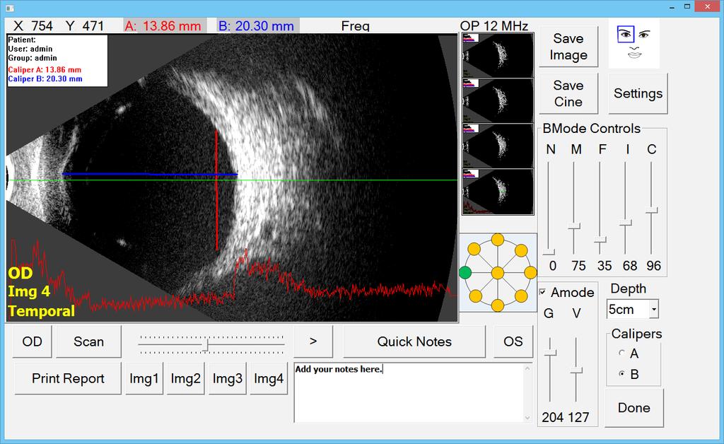PalmScan Mobile USB B-Scan The Mobile B-Scan is MMD s portable and extremely versatile ultrasound device. The B-Scan is easy to use with custom settings and a patient database.