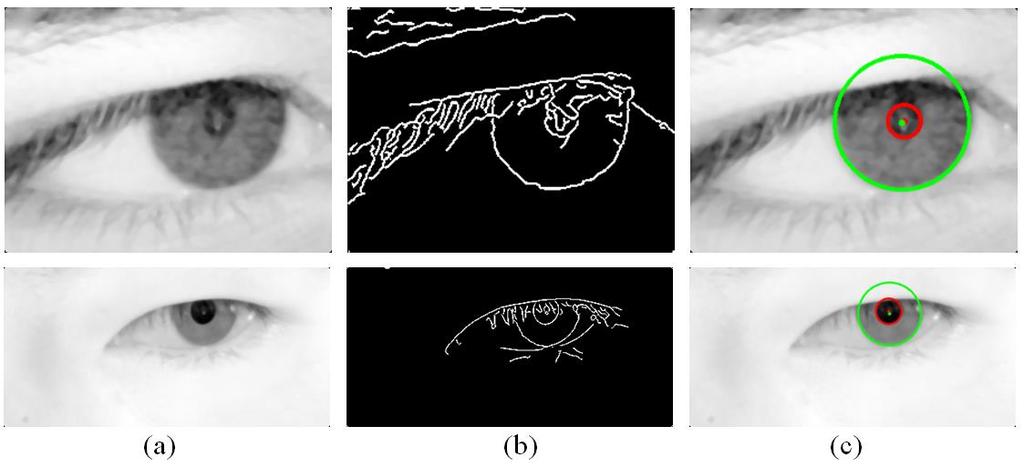 Figure 6: Limbic and pupillary boundaries localization. (a) Input smoothed image Localized limbic and pupillary boundaries.