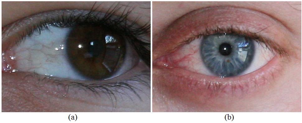 Figure 16: Iris recognition performance for FRGC database. (a) ROC and, (b) CMC for the proposed method and the baseline. Figure 17: Iris pigmentation.