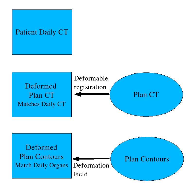 Auto-Segmentation Deform plan CT to daily CT Determined deformation field deforms plan