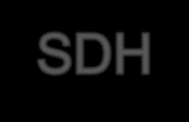 How to move away from SDH?