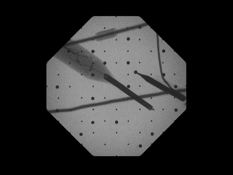(a) Fluoroscope image (b) Dewarpped image Figure 3.11: Dewarpped image. (a) Original image from the fluoroscope. (b) Image after dewarping.