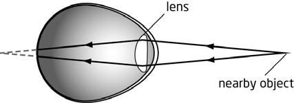 a. near-sightedness c. presbyopia b. far-sightedness d. accommodation 15. The film in a camera and the in an eye perform a similar function. a. retina c. lens b. optic nerve d. iris 16.