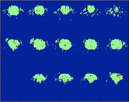 Figure 1 Feature Mapping after dimensionality Reduction, green: brain mask (15 slices),