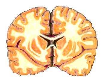 section of the brain below in Figure 5. We can see that the brain is composed of tissues that fold in on themselves at the edges and in towards the center of the entire structure.