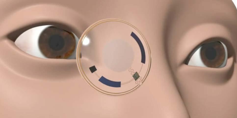 SMART CONTACT LENS for