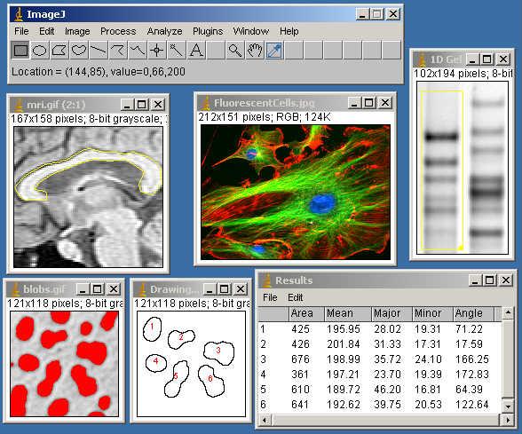 Chapter 8 Figure 8.26: ImageJ toolbar (upper left) and examples of image data. This image is from the ImageJ Web site, http://rsb.info.nih.gov/ij/index.