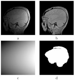 Background Ex: MRI Field variations produce non-uniform