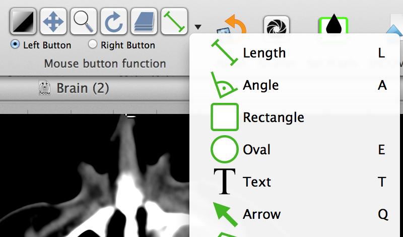 Appendix 2 Optional extras for Mac users Reorientating and annotating images Use the mouse button functions to mark arrow, rotate, resize or reposition images as required.