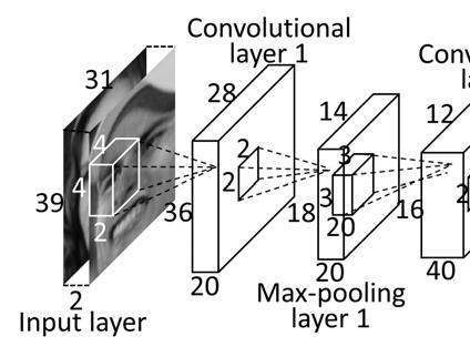 The 3D convolution kernel sizes of the convolutional layers and the pooling region sizes of the max-pooling layers are shown as the small cuboids and squares inside the large cuboids of maps