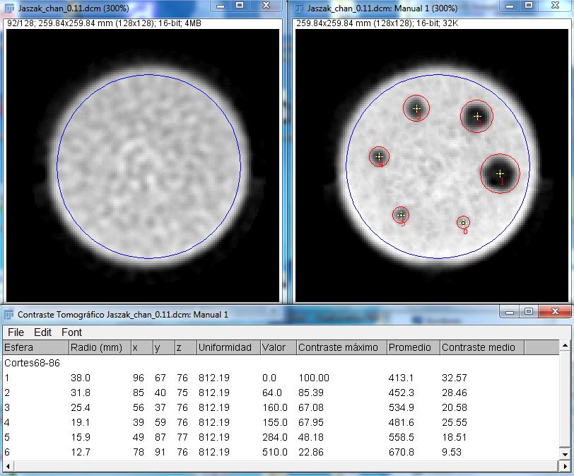 7- Enter the requested data for tomographic contrast calculations, as shown in Figure 36B. Then select the appropriated data related to spheres and tank diameter.