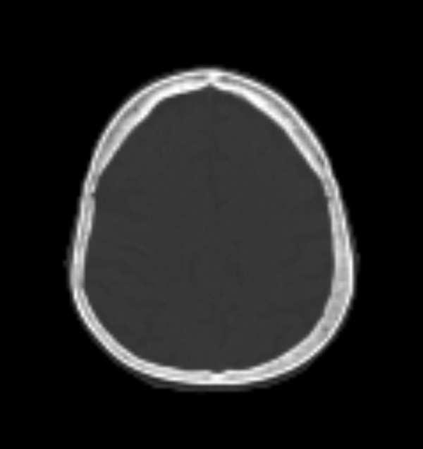 (a) is 8 8 53 brain CT image sequence, experiment images are selected with 3-4 intervals from the CT sequence. Figure.