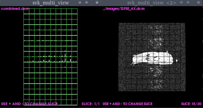 As an alternative to the SIVIC GUI the svk_multi_view command can be used to quickly render both images and spectra: LINUX/OSX Terminal svk_multi_view -s combined.dcm images/t2fse_ax.
