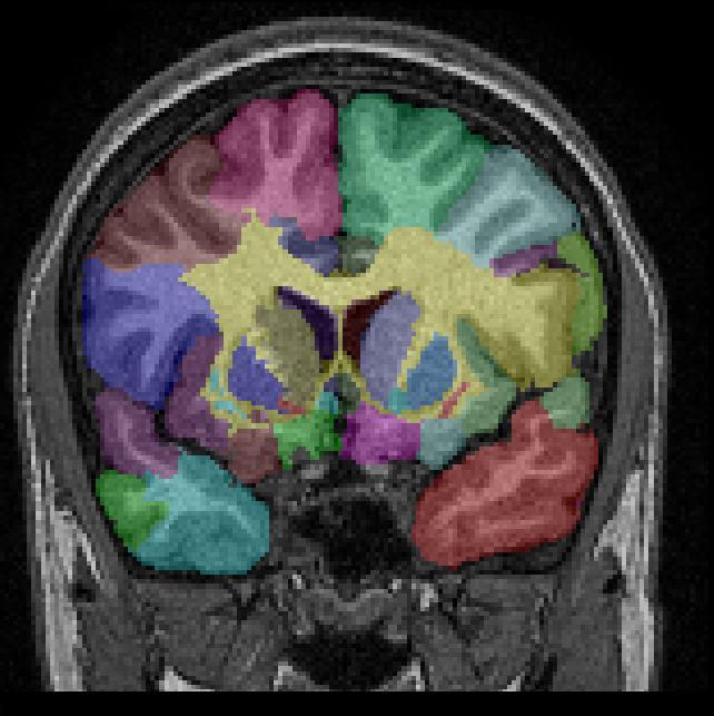 Tractography &