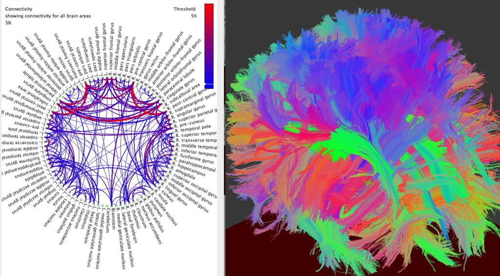 Tractography & connectivity Fiber tracking in