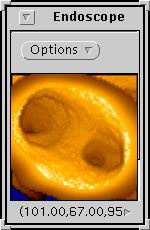 A. General Visualization and Analysis Tools Virtual Bronchoscopy for 3D Pulmonary Image Assessment: Visualization and Analysis William E.