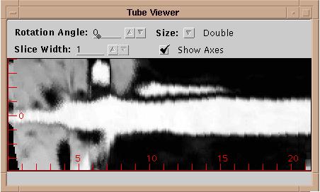 6. See a straightened Tube View