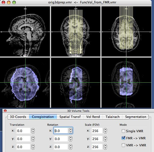 Performing manual alignment for functional to anatomical images Step 1: preparation First, open the anatomical image (*.vmr).