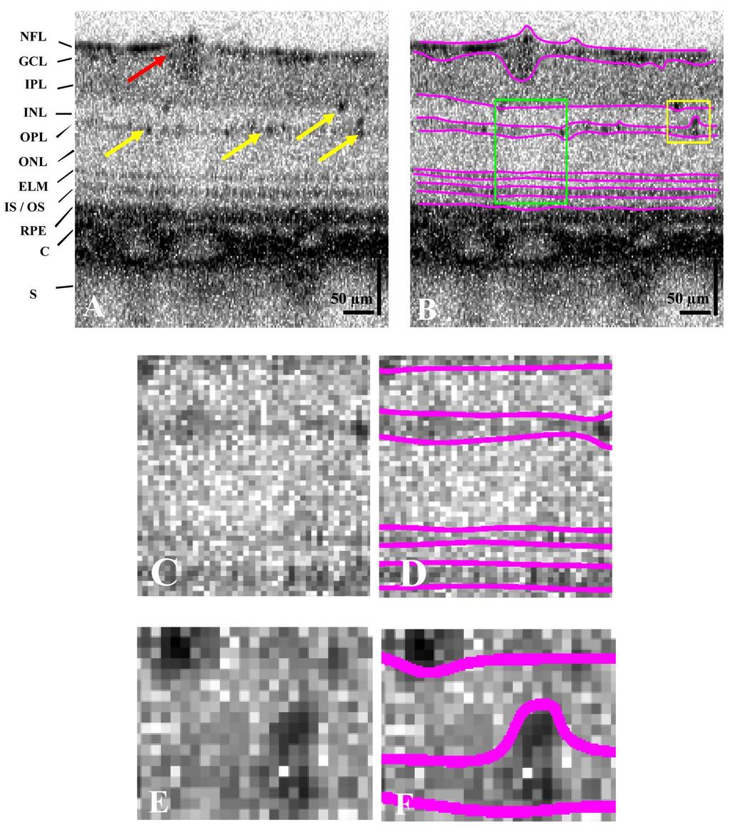 Fig. 3. OCT cross-sectional tomograms (1000 x 250 pixels) of a healthy rat retina acquired in-vivo. Fig.