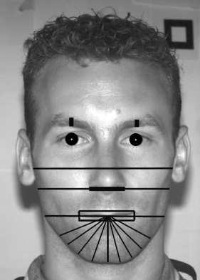 Literature Review Feature analysis techniques involve the localisation of facial features, followed by measurements of these features characteristics and relative positions.