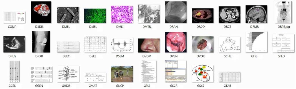 IBM IMARS Spatial Gridding First position in 1 st and 2 nd ImageCLEF Medical Imaging Classification Task: Determine