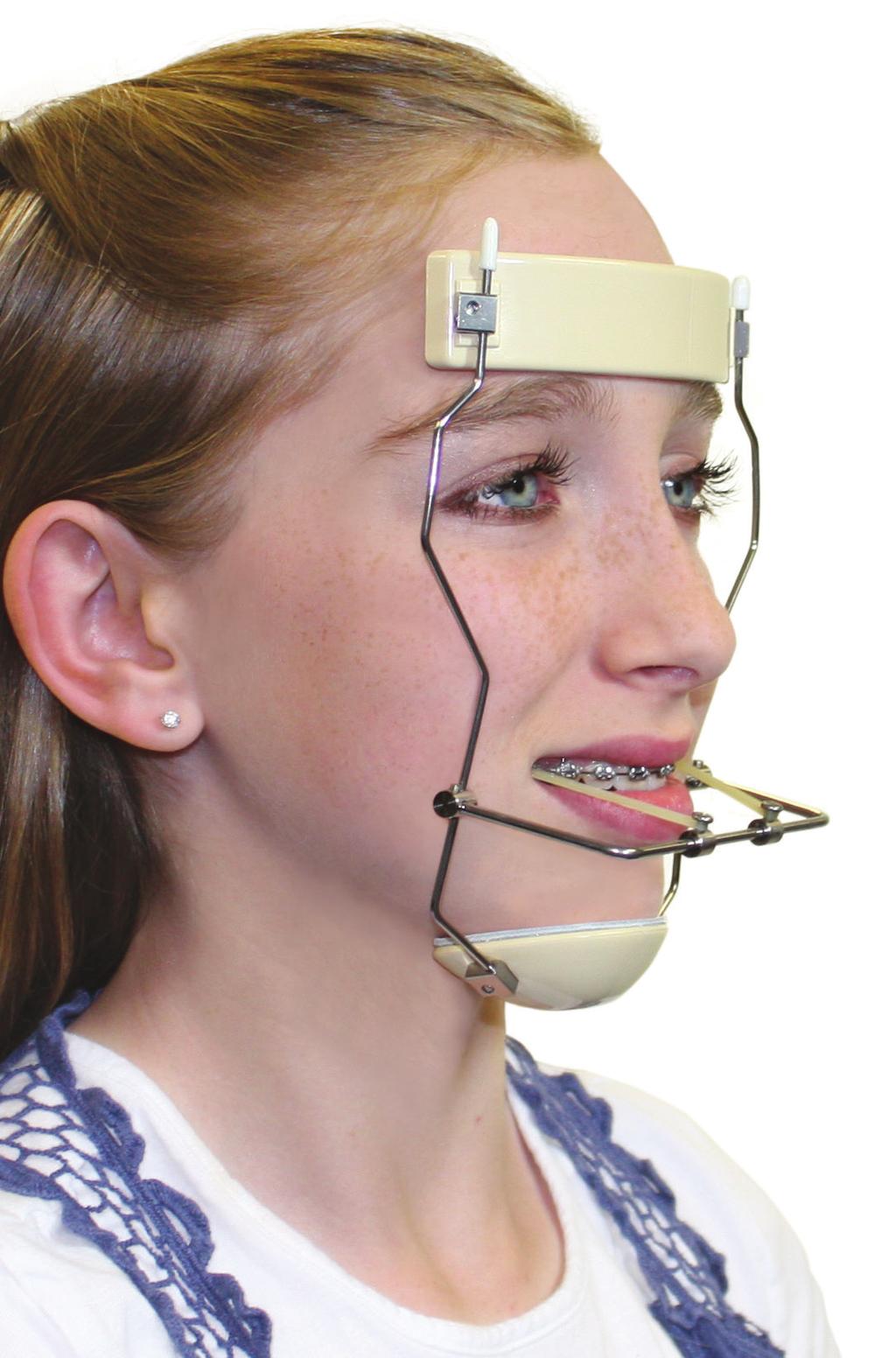 Large Small Reverse Pull Facemask Fully Adjustable Comfort Design Aids in Patient Compliance Maximum patient comfort Treats