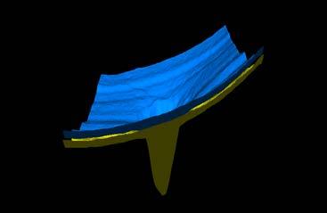 (b) The 3D view of the segmented surfaces. (c) The flattened OCT B-scan. (d) The corresponding OCT projection image. considered for the registration.