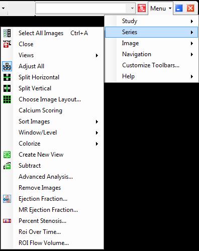 NovaPACS Diagnostic Viewer Chapter 11 Using the Image Viewer Series Menu The Image Viewer s Series Menu contains many functions to help users as they examine and mark findings in series.