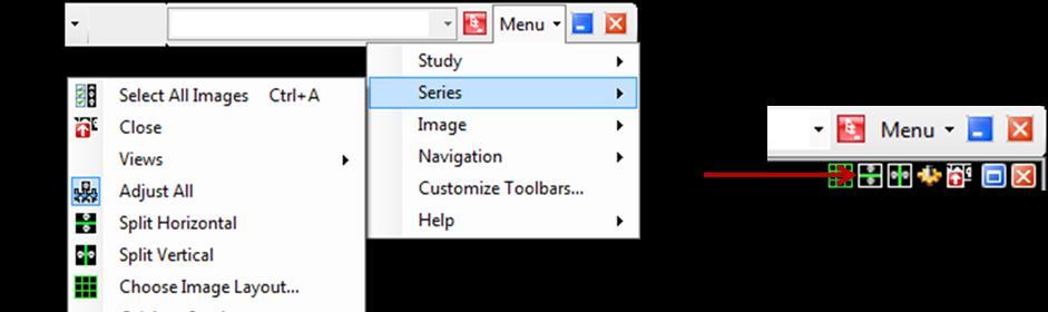 Chapter 11 Using the Image Viewer Series Menu To use the Split Horizontal option, click on the Image Viewer s Menu in the top right of the window and select the Series Menu.