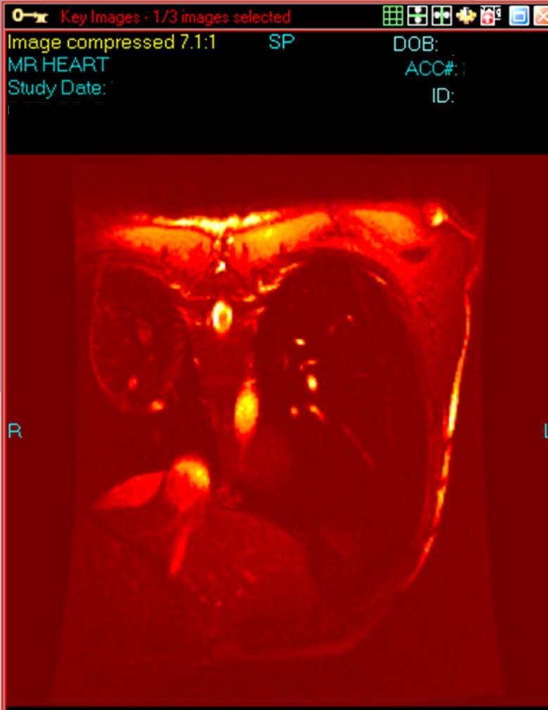 NovaPACS Diagnostic Viewer Chapter 14 Cardiology Features Novarad provides many features for Cardiologists, from a Cardio reporting system to cardiology-specific measuring