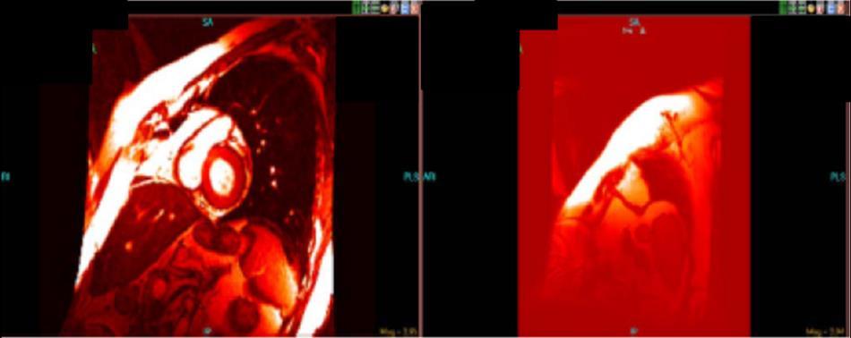 NovaPACS Diagnostic Viewer Chapter 14 Cardiology Features 2. Click on the Image Viewer s Menu in the top right of the window and select the Series Menu.