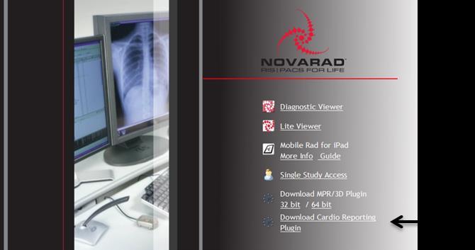NovaPACS Diagnostic Viewer Chapter 14 Cardiology Features Note: Users must use Internet Explorer 9 for best results with EncaptureMD s reports.