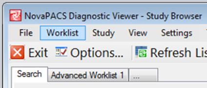 The Remove Worklist Item and Clear Worklist options on the Worklist menu on the Study Br