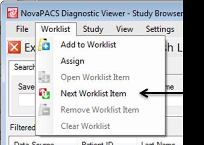 Chapter 4 Using the Study Browser Worklist Menu 4-3 Open Worklist Item Users can open Worklist studies in the Image Viewer.