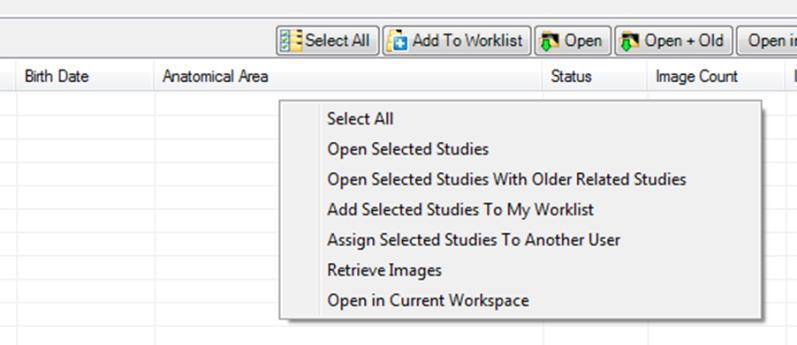 Click on the Study Menu on the Study Browser s main toolbar and select the Select All option. The following are alternate ways to use the Select All option: 1.