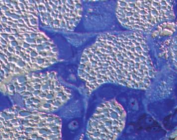 Toluidin blue staining of a histology section after embedding in methacrylate.