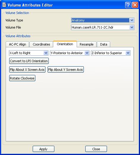 Figure 4 - Volume Attributes Editor Dialog If you use a volume type that has sufficient metadata that describes the volume s orientation (such as an AFNI volume) Caret5 will automatically convert the