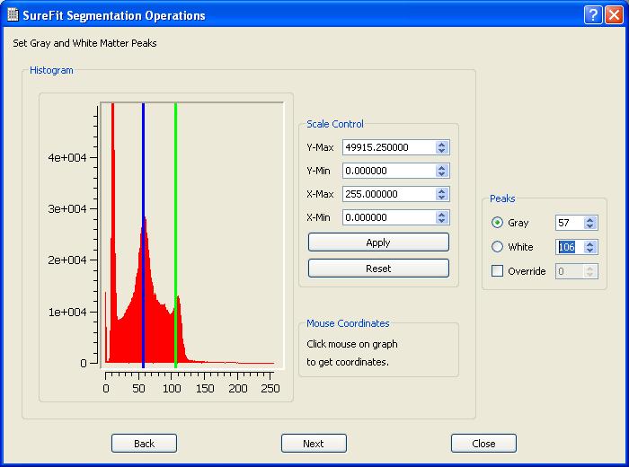 Figure 18 - SureFit Operations Set Gray and White Matter Peaks Page The Segmentation Operations Page allows the user to choose the operations that are to be carried out during the segmentation