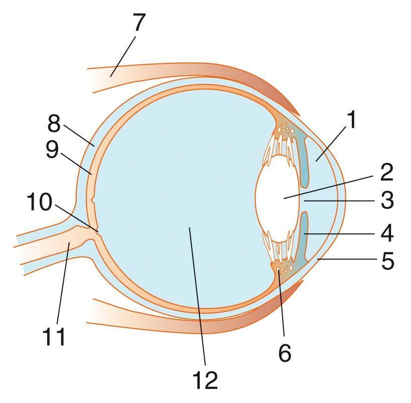 36. Complete the ray diagrams for the following two lenses. Label the image as real or virtual. [6] 37. Human vision can be corrected using lenses.