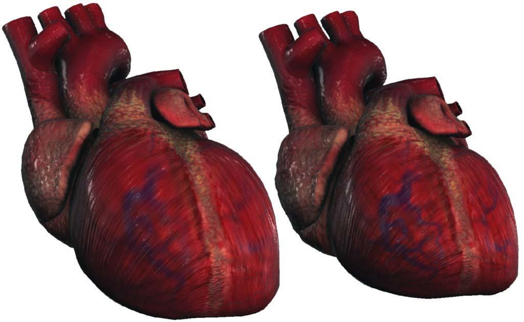 Chapter 4: Rendering Gooey Materials with Multiple Layers Figure 11. Two frames of a beating human heart animation that was rendered using the techniques described in this chapter.