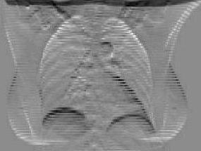 Gradient filter each projection image along Cranial-Caudal (CC) direction 2.
