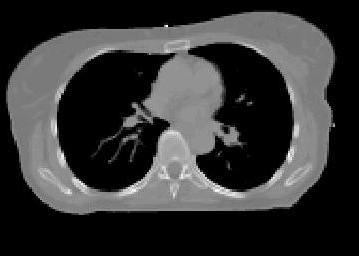Simulation and results Data setup Reference volume: 192 x 160 x 60 breath-hold thorax CT