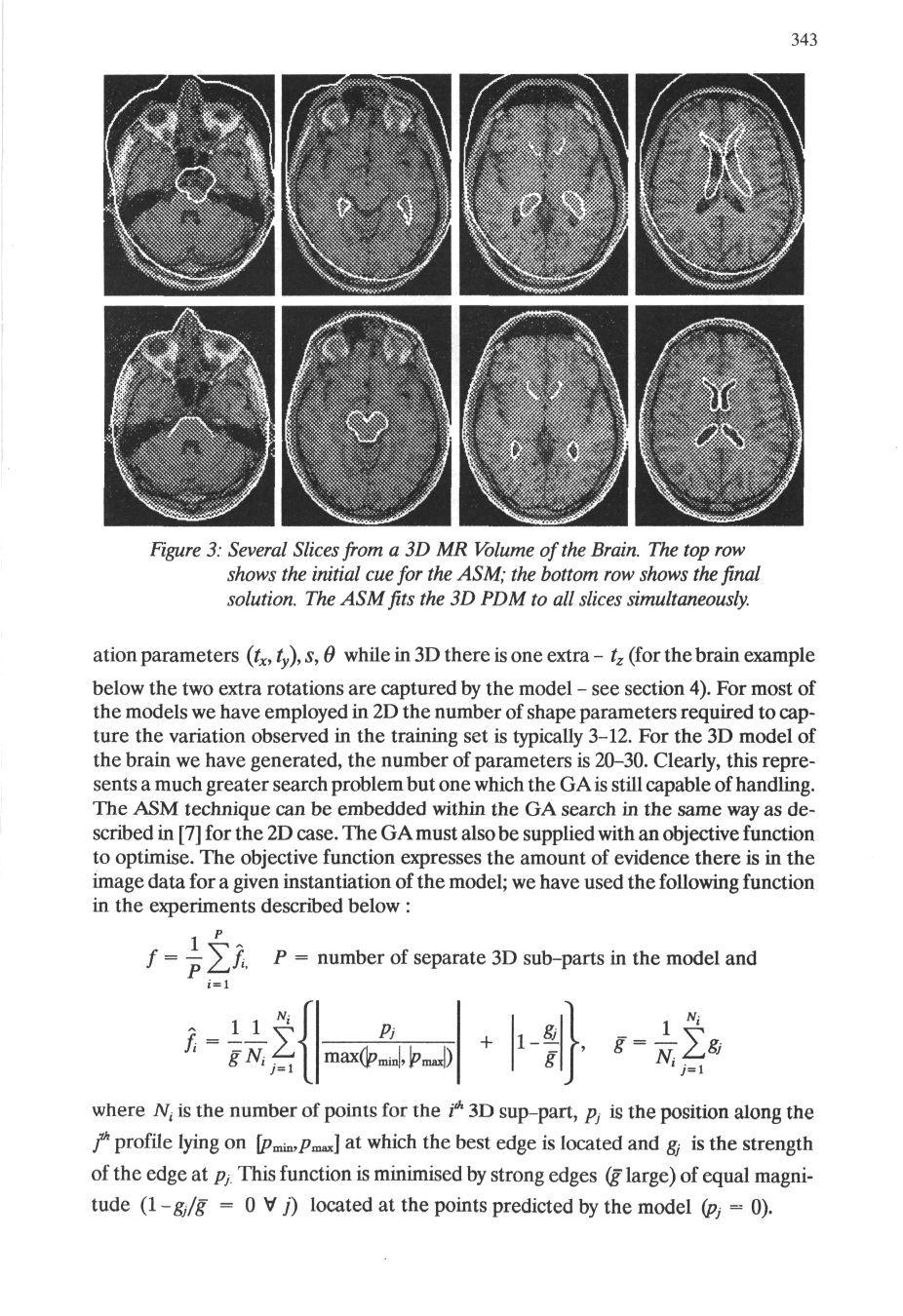 343 Figure 3: Several Slices from a 3D MR Volume of the Brain. The top row shows the initial cue for the ASM; the bottom row shows the final solution.