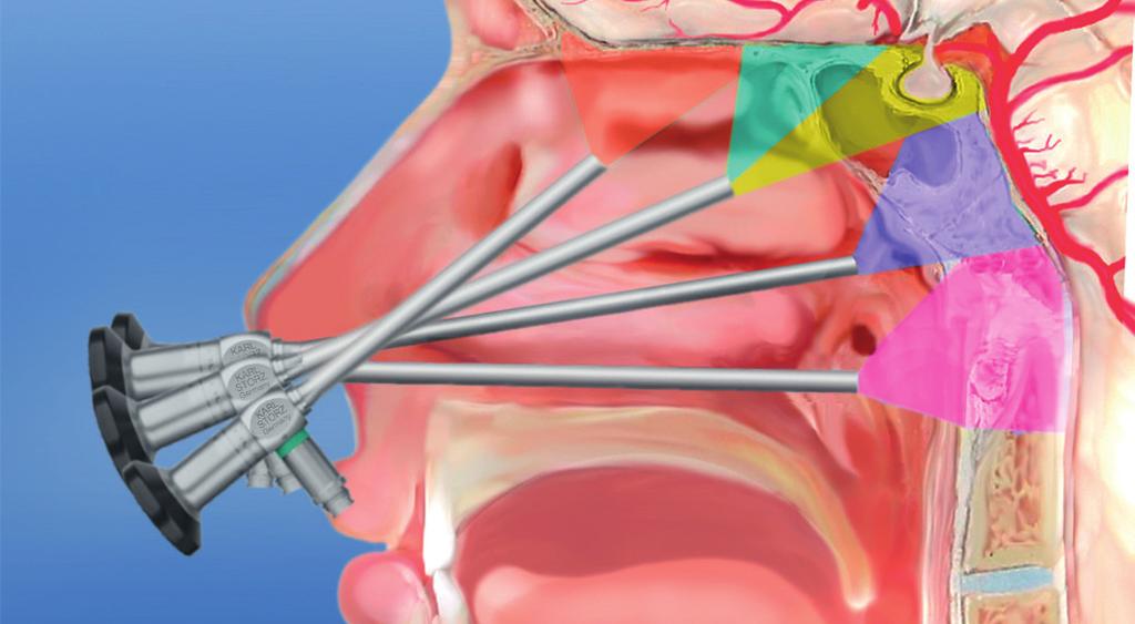Endonasal Instruments Over the years, the development of the endonasal corridor to the pituitary gland and to the skull base fueled the design of an entirely new line of instruments dedicated to