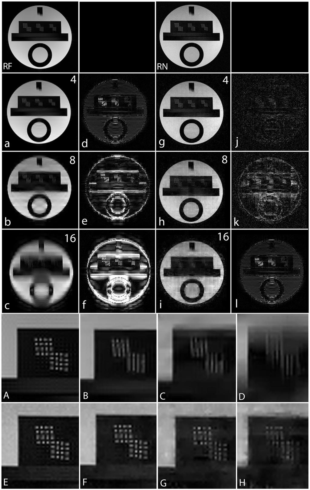 Figure 12: MCS-MRI reconstruction on the acquired noiselet encoded and Fourier encoded data for different acceleration factors (up/down: phase encodes, left/right: frequency encode).