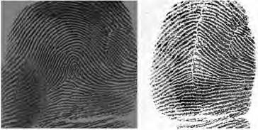 Further factors such as skin disease (such as leprosy) and side effects of a cancer drug can also obliterate fingerprints.