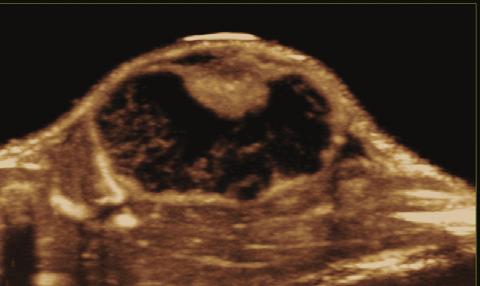 The world s only customizable imaging platform combining ultra high frequency ultrasound and photoacoustics Experience the next generation of
