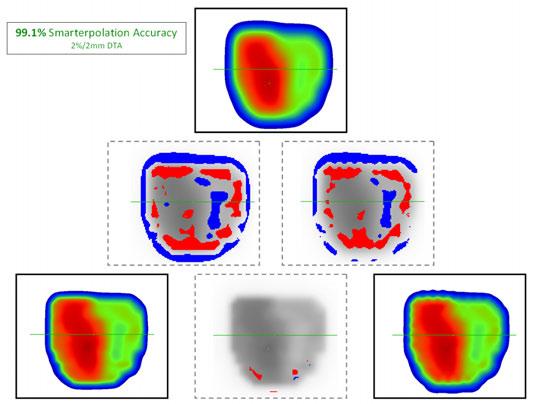 Verification of Smarterpolation high-density restoration Figures 9 and 10 show examples of how Smarterpolation takes a low density MapCHECK array and creates an accurate high density array.