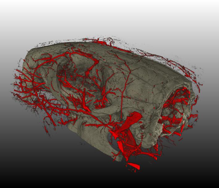 Rat skull Detail of trabecular bone structure Mouse bone fracture MicroCT Imaging X-ray energy range: 20 100 kev 43