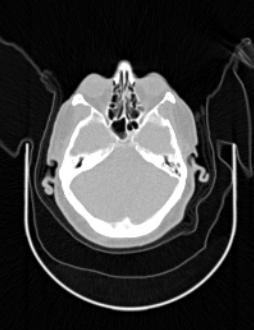ML reconstruction for CT